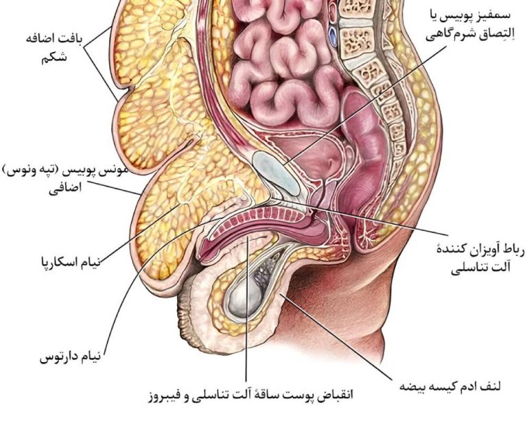 آلت تناسلی نهفته یا پنهان چیست؟ علل و درمان در کودکان و بزرگسالان