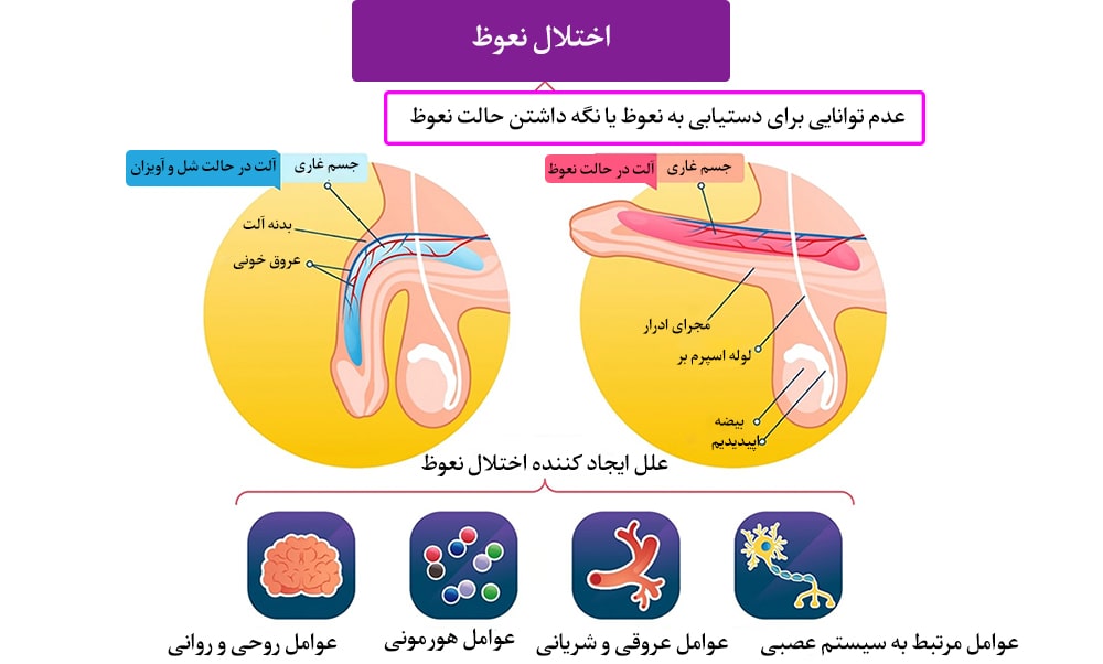 اختلال نعوظ چیست