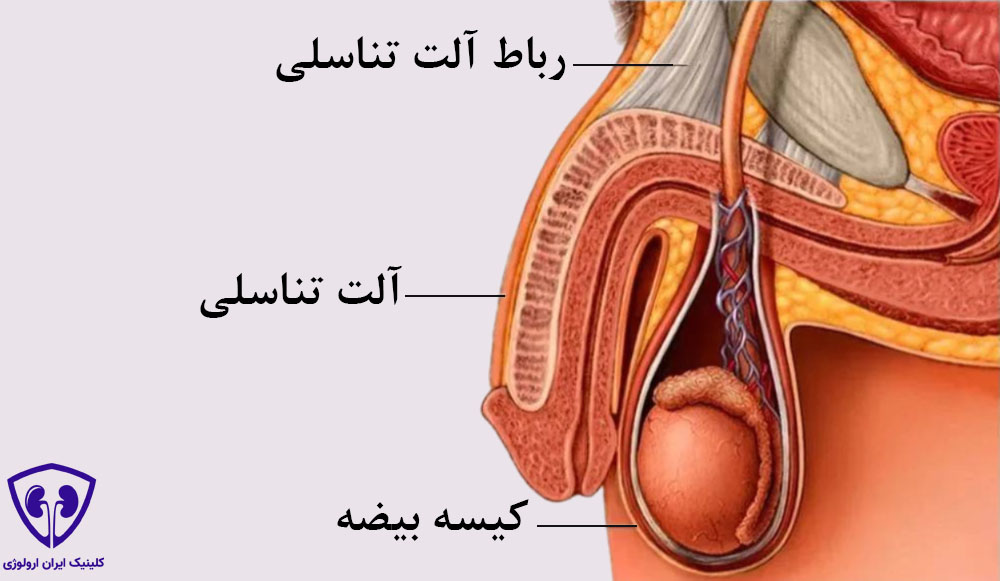 افزایش طول آلت تناسلی با جراحی قطع لیگامان